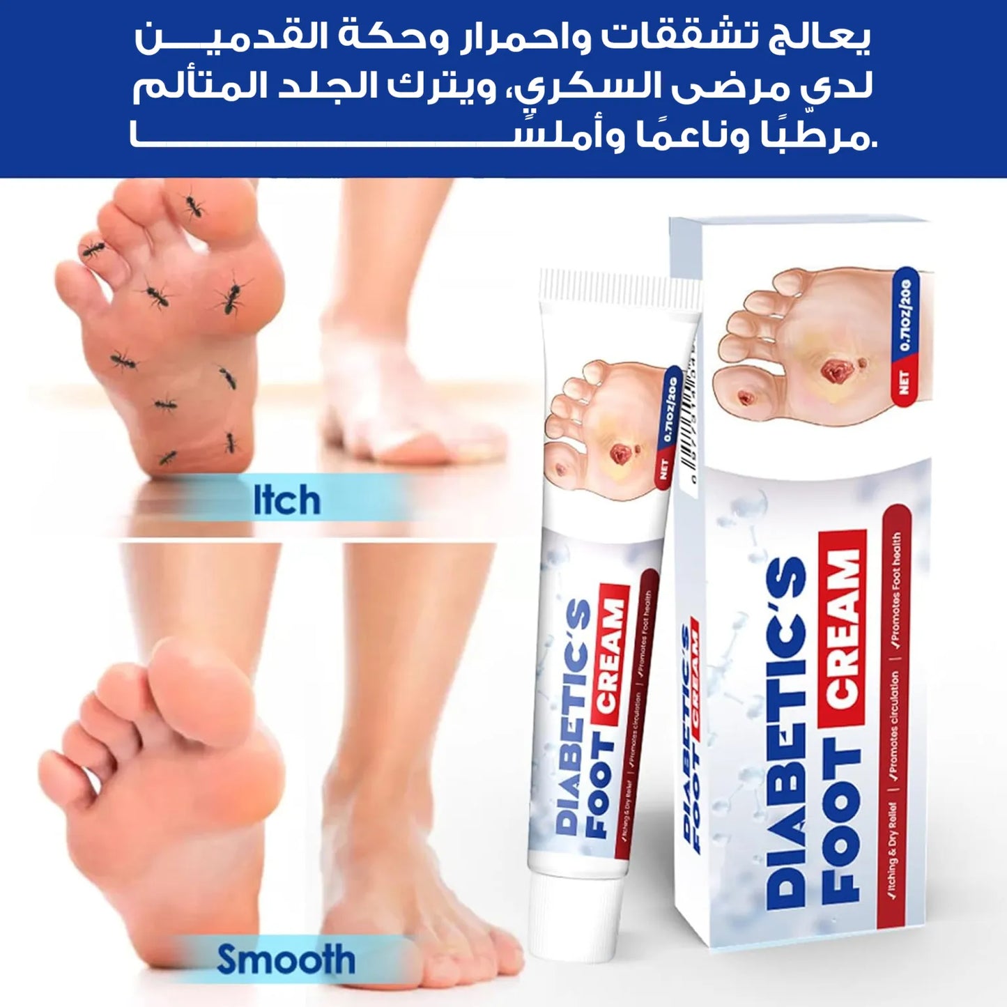 كريم لعلاج قرح القدم السكري من South Moon – 20 جرام