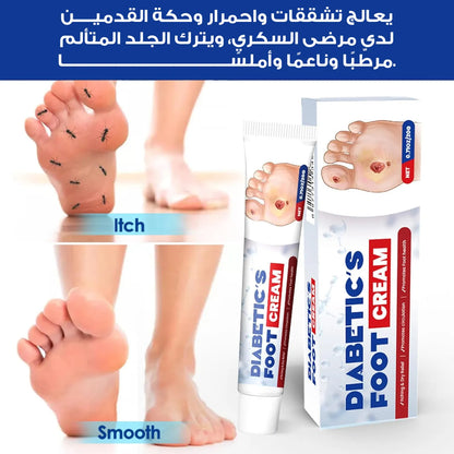كريم لعلاج قرح القدم السكري من South Moon – 20 جرام